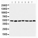 CtBP1 Antibody