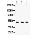 CTBP2  Antibody