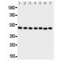 CTBP2 Antibody