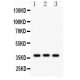 CTGF  Antibody