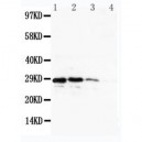 CUEDC2 Antibody