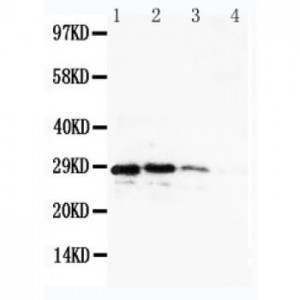 CUEDC2 Antibody