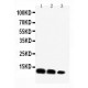 CXCL16 Antibody