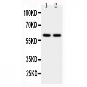 CYP11A1 Antibody