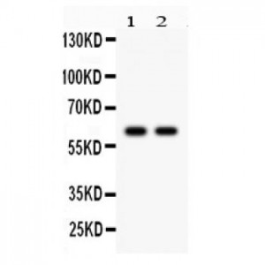 CYP1B1  Antibody