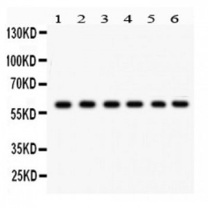 CYP24A1  Antibody