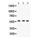 CYP27B1  Antibody