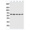 CYP2U1 Antibody