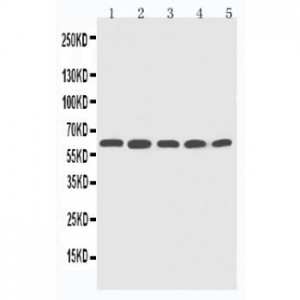 CYP2U1 Antibody