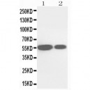 Cytochrome P450 2E1 Antibody