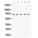 Cytokeratin 1  Antibody