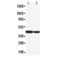 Cytokeratin 19 Antibody