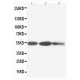 Cytokeratin 8 Antibody