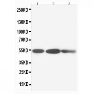 Cytokeratin 8 Antibody