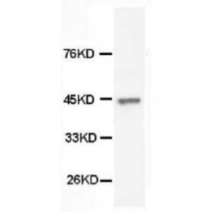 Cytokeratin Peptide 18 Antibody (monoclonal)