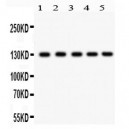 Daxx  Antibody