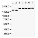 DCC Antibody