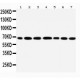 DDX5 Antibody