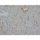 Desmin Antibody (monoclonal)