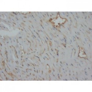 Desmin Antibody (monoclonal)