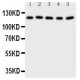 Desmoglein 2 Antibody