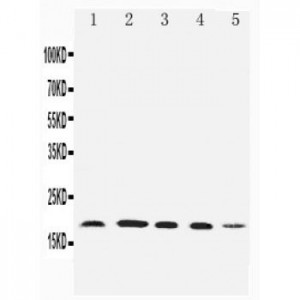 Diubiquitin Antibody