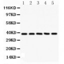 Dkk3  Antibody