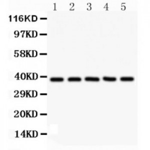 Dkk3  Antibody