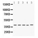 DMRT1 Antibody