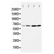 Dopamine Receptor D1 Antibody