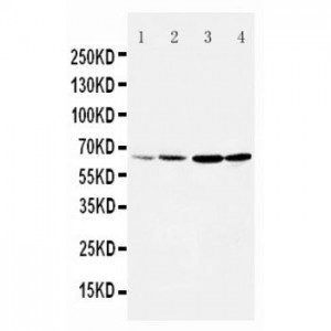 Dopamine Receptor D1 Antibody