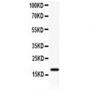 Dysadherin Antibody