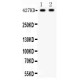 Dystrophin  Antibody