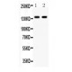 E Cadherin  Antibody