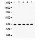 EBAG9  Antibody