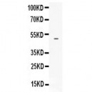 EDNRB  Antibody