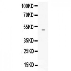 EDNRB  Antibody