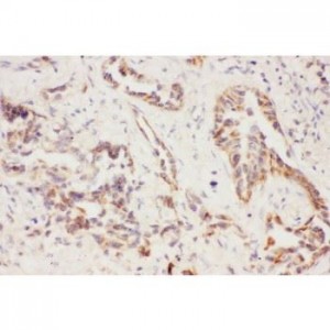 Eotaxin 3  Antibody