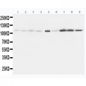 Eph receptor A1 Antibody