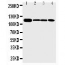 Eph receptor A2 Antibody