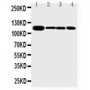 Eph receptor A2 Antibody