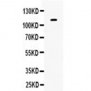 Eph receptor B1  Antibody