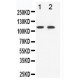 Eph receptor B3 Antibody