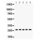 ERAB Antibodyd&trade; Antibody