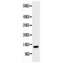 Estrogen Inducible Protein pS2 Antibody