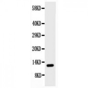 Estrogen Inducible Protein pS2 Antibody