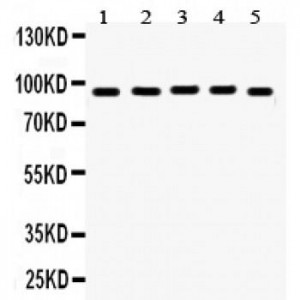 EWSR1  Antibody