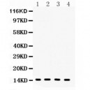 FABP4 Antibody