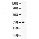 Fas  Antibody