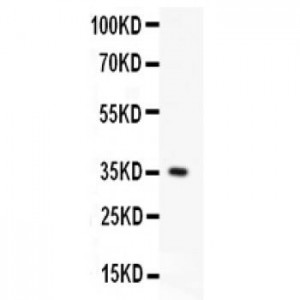 Fas  Antibody